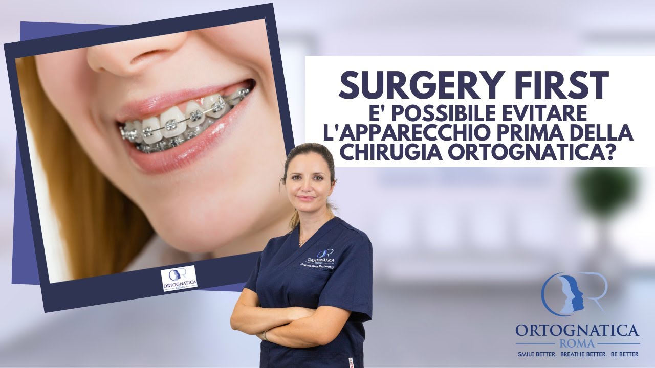 Surgery First: è possibile evitare l'apparecchio prima della chirurgia ortognatica?