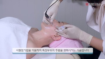 GCP KOREA 피부 교육 영상 자료 아리더마 MTS관리