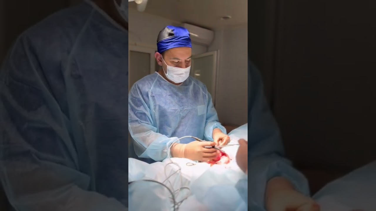 Киста яичка | Оперативное лечение