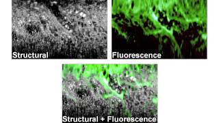 Robert McLaughlin, Microscope in a needle, SPIE, April 2014 screenshot 5