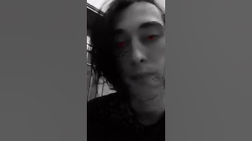 RILEY BABY, CODE10 - Snippet 2.11.21