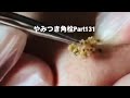 【acne pimple】やみつき角栓Part131