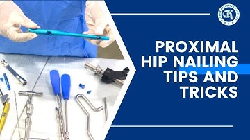 Proximal Hip Nailing