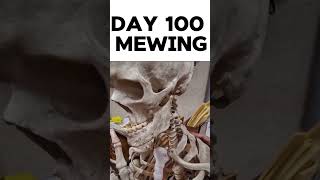Day 100 Mewing