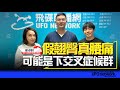 飛碟聯播網《青春永遠不會老》 朱衛茵、西恩 主持 2023.11.22  假翹臀真腰痛，可能是下交叉症候群    #物理治療 #巫卓軒 #居家運動    #腰痛 #下交叉症候群