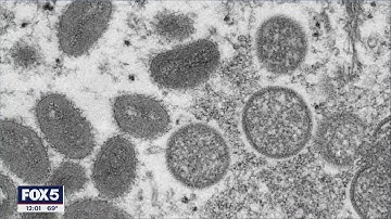 NYC declares monkeypox state of emergency