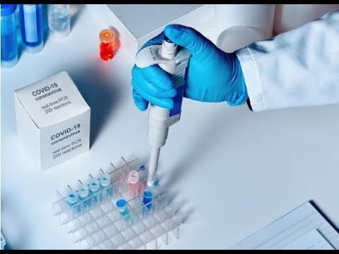 საქართველოში ჩინეთიდან 40 ათასი PCR და 20 ათასი ანტისხეულების ტესტი ჩამოვიდა