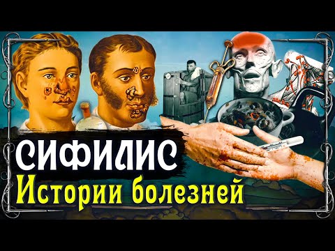Самая стыдная и загадочная болезнь в истории человечества