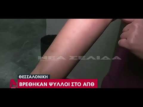 Βίντεο: Το ξίδι μηλίτη μήλου σκοτώνει τους ψύλλους