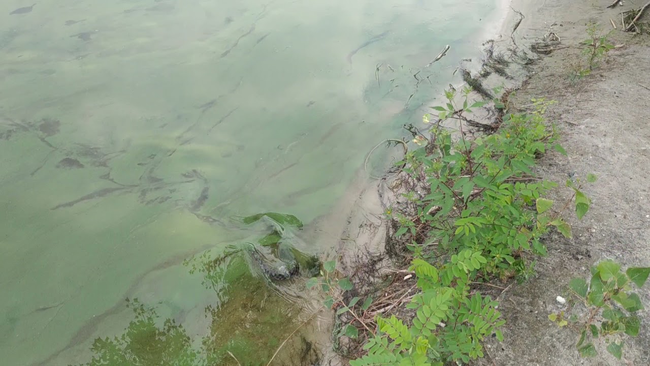 Как вылечить гепатит "С" без лекарств?! Гепатит "Ц" - это не приговор ...