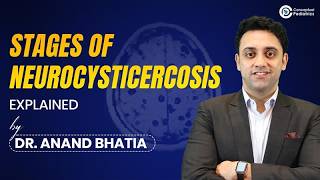 Why Does Neurocysticercosis Cause Seizures? Stages Ct Signs Dr. Anand Bhatia