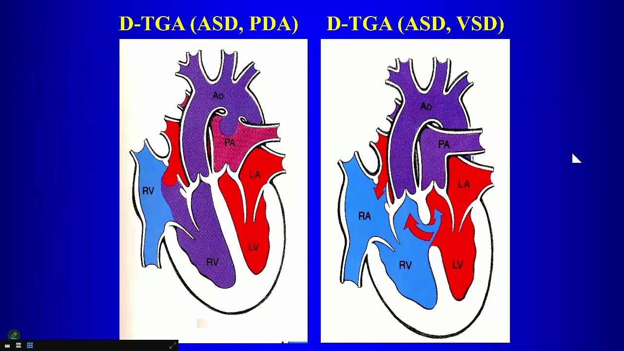 17 Admixture Lesions