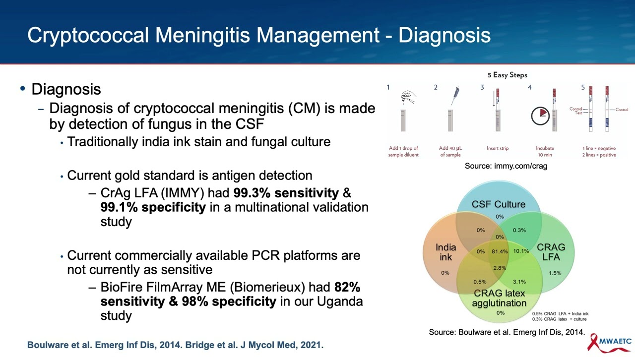 Updates in Cryptococcal Meningitis Management