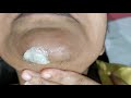 How to remove hard hair/ with wax How to remove facial hair How to remove hard hair Chin / upper lip