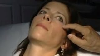 How Long Does Botox Last?