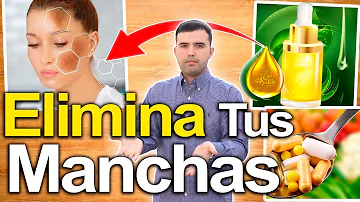 ¿La vitamina C elimina las manchas oscuras de la cara?