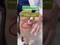 PCOS Fatigue Relief | ST36 Acupressure Point to Boost Energy Naturally