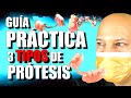 TIPOS de PRÓTESIS REMOVIBLES (comparativa)