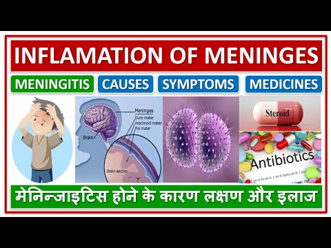 MENINGITIS, INFLAMATION OF MENINGES OF BRAIN, TREATMENT, मेनिन्जाइटिस होने के कारण लक्षण और इलाज