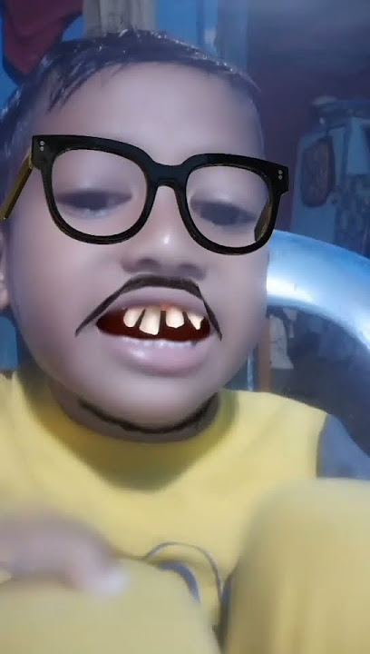 Gigi tonggos#wargasomplak