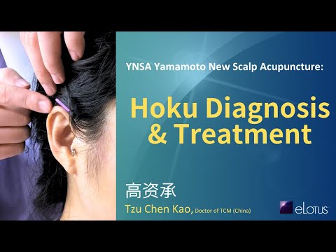YNSA Yamamoto New Scalp Acupuncture: Demonstration of Hoku