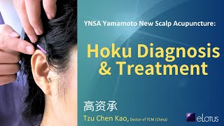 YNSA Yamamoto New Scalp Acupuncture: Demonstration of Hoku