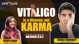 Meet Shivaji Choudhary who wears Vitiligo with PRIDE | Lt 27