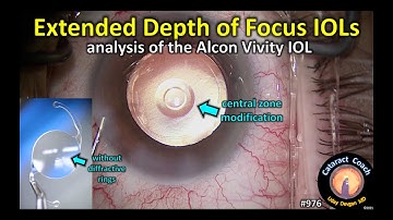 Extended Depth of Focus IOLs (EDOF Lens) for cataract surgery - Alcon Vivity