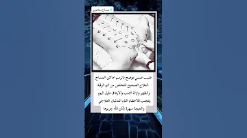 طبيب صيني يوضح بالرسم اماكن المساج الصحيح للتخلص من الم الرقبة والظهر طبيب صيني يوضح بالرسم اماكن المساج الصحيح للتخلص من الم الرقبة والظهر