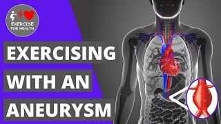 How safe is it to exercise with an Aneurysm?