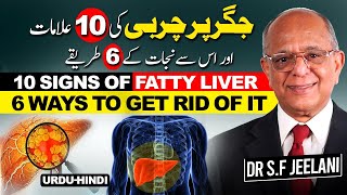 Get rid of liver fat or Fatty Liver naturally | جگر کی چربی دور کرنے کے قدرتی طریقے | हिंदी