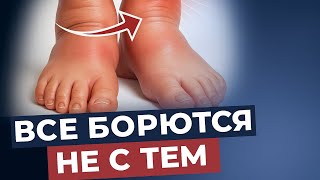 Отеки: простой метод с содой, который работает!!!