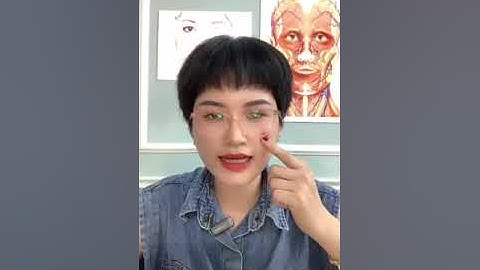 Học tiêm Filler & botox: Làm sao để tiêm rãnh cười đẹp?