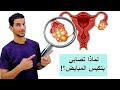 ساخبرك بالسبب الخفي للاصابة بتكيس المبايض العلاج في 5 خطوات فقط 