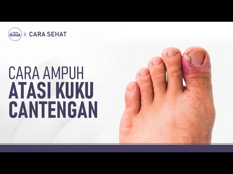 Cara Kuku Cantengan
