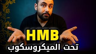 هل مكمل HMB فعلاً بيكبر العضلات؟ ولا مجرد وهم؟