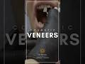 Let’s talk Veneers!