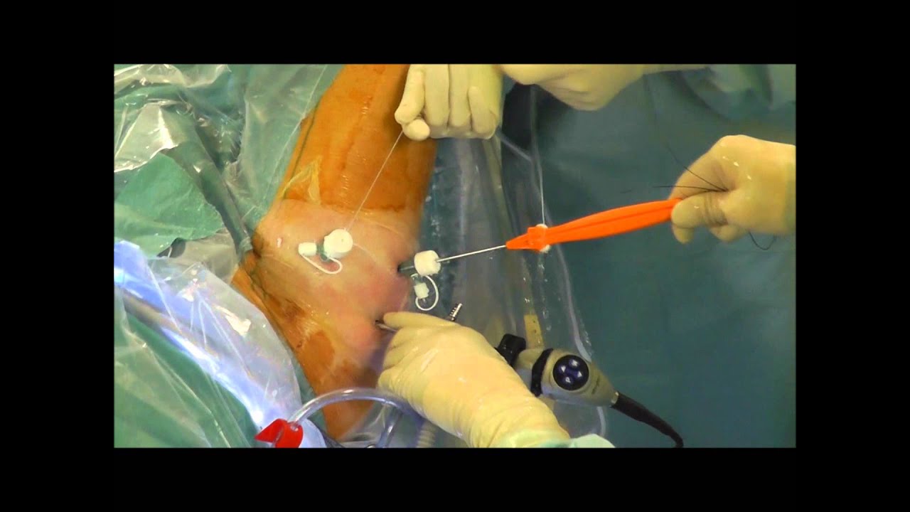 Exteriores Capsula corto camera iphone 8 plus apk