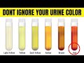 What Your Urine Color Says About Your Health | Healthy Urine Color