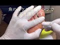 あっという間に魚の目が取れる瞬間映像パート2 ドクターネイル爪革命 用賀店