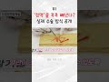 하지정맥류 수술 방식 "보행정맥절제술" 과정