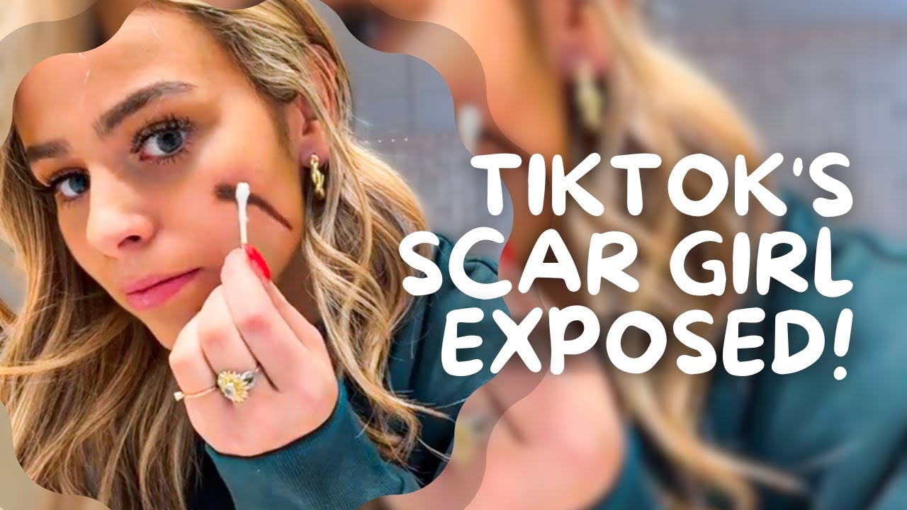 Scarr Girl Rapper TikTok's Scar Girl Exposed. - YouTube
