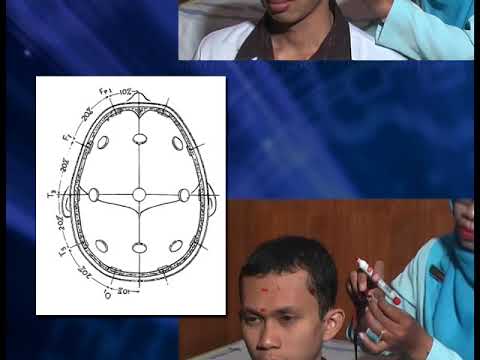 Video: Sistem Bimbingan Elektrod Berasaskan Realiti Yang Diperkayakan Untuk Elektroensefalografi Yang Boleh Dipercayai