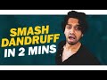 Dandruff Problem Solved In 2 Minutes || Aye jude!