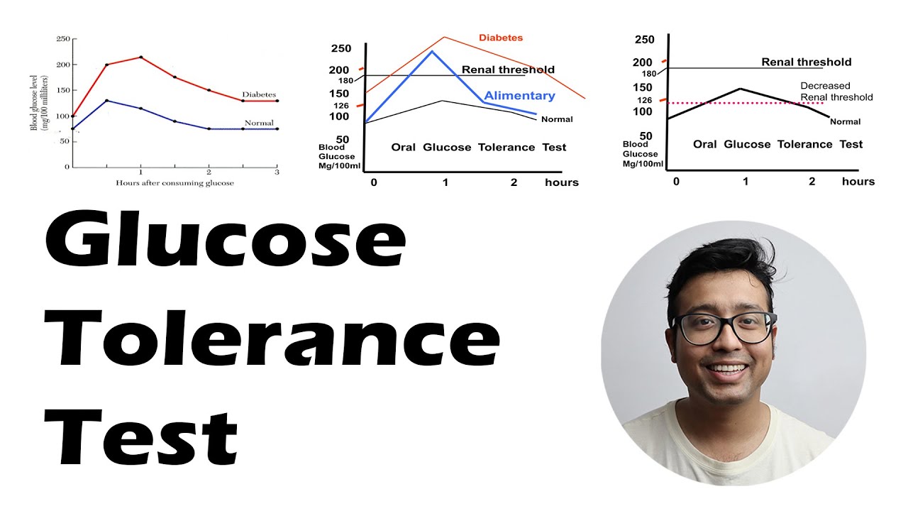 Glucose Tolerance Test - In depth Analysis: All topics possible covered. BI 3.8 3.9 3.10
