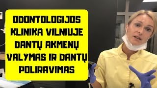 Odontologijos Klinika Vilniuje Dantų Akmenų Valymas Ir Dantų Poliravimas