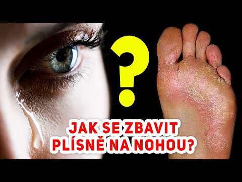 Video: Jak zastavit agresi psa vůči ostatním psům