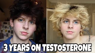 3 YEARS ON TESTOSTERONE (FTM TRANSGENDER) | NOAHFINNCE