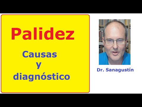 Palidez: causas y diagnóstico