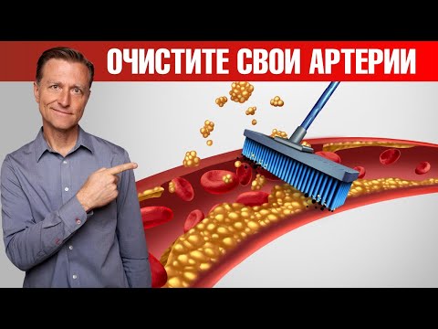 Бляшки в сосудах? Лучший обед для сердечно-сосудистой системы👍